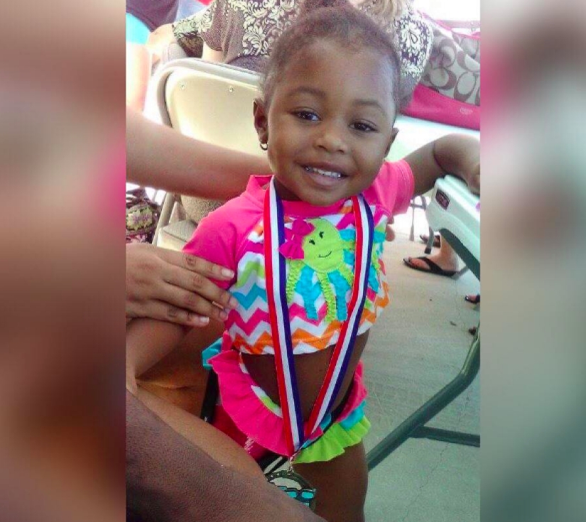 Aurora Cairo is a charming 2—year-old baby with a prosthetic leg