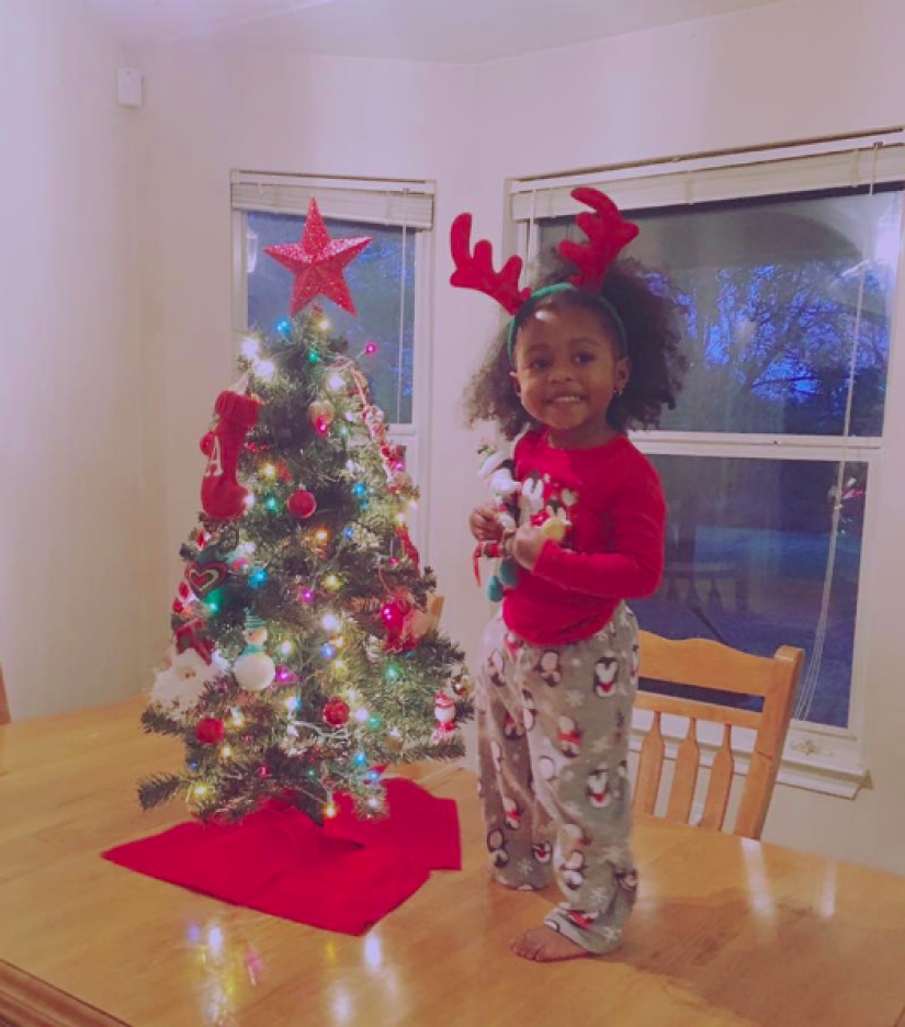 Aurora Cairo is a charming 2—year-old baby with a prosthetic leg
