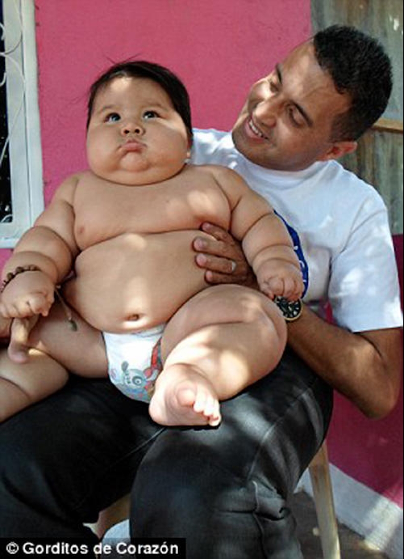 Bebe obeso de 8 meses es arrebatado a sus padres Bebe obeso de 8 meses es arrebatado a sus padres