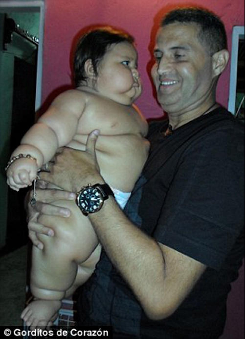 Bebe obeso de 8 meses es arrebatado a sus padres Bebe obeso de 8 meses es arrebatado a sus padres