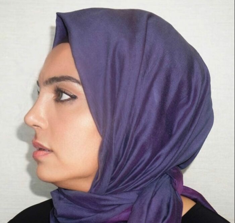 Before And After Photos From Turkish Plastic Surgery Clinic Have Left People Baffled