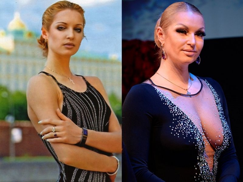 Before fame and plastic surgery: 15 photos of what Russian stars looked like in their youth Before fame and plastic surgery: 15 photos of what Russian stars looked like in their youth