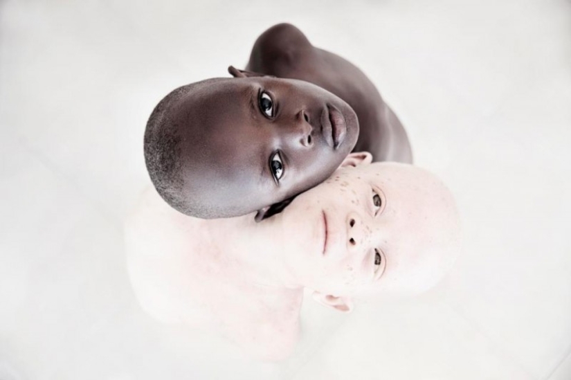 Blancura mortal: Retratos increíbles de los albinos de Tanzania
