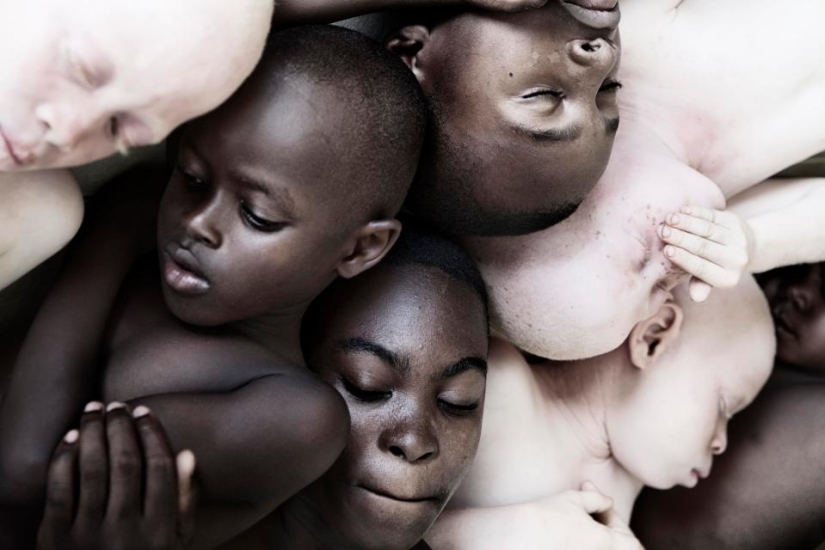 Blancura mortal: Retratos increíbles de los albinos de Tanzania