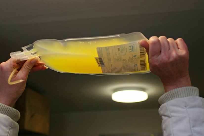 Blood business: anti-aging transfusions are growing in popularity in the United States. But is it of any use to them?