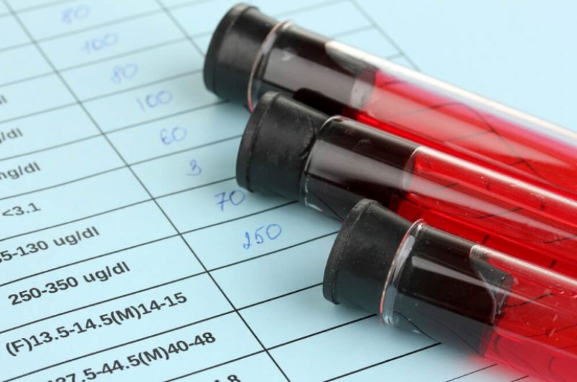 Blood business: anti-aging transfusions are growing in popularity in the United States. But is it of any use to them?