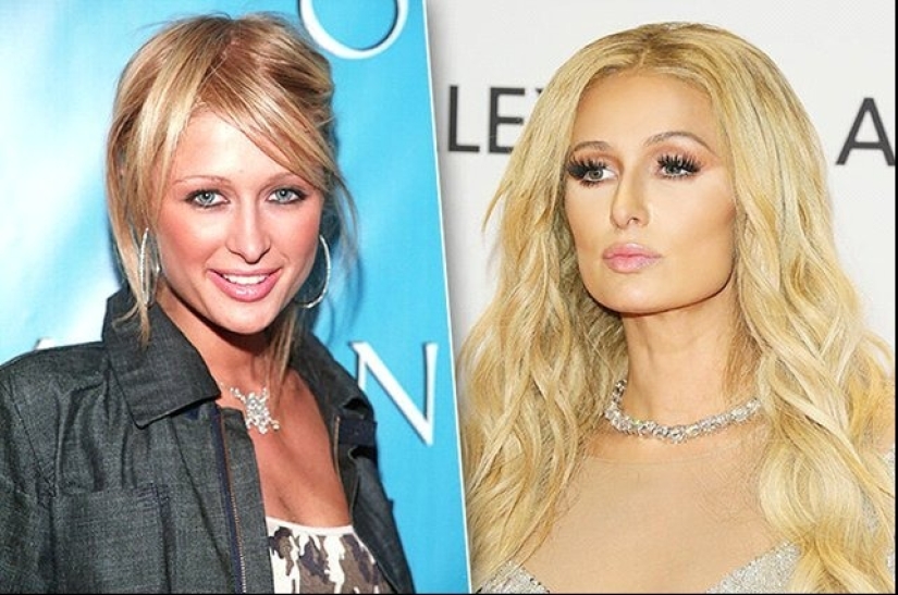 Celebridades que se hicieron un aumento de labios: fotos que sorprenden