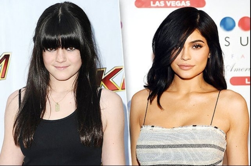 Celebrities Who Had Lip Augmentation: Photos That Surprise