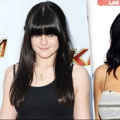 Celebrities Who Had Lip Augmentation: Photos That Surprise Celebrities Who Had Lip Augmentation: Photos That Surprise