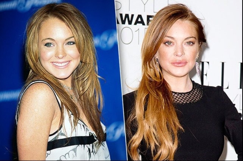 Celebrities Who Had Lip Augmentation: Photos That Surprise