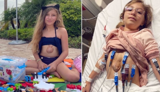 Cómo vive Betsabé: una niña con corazón afuera