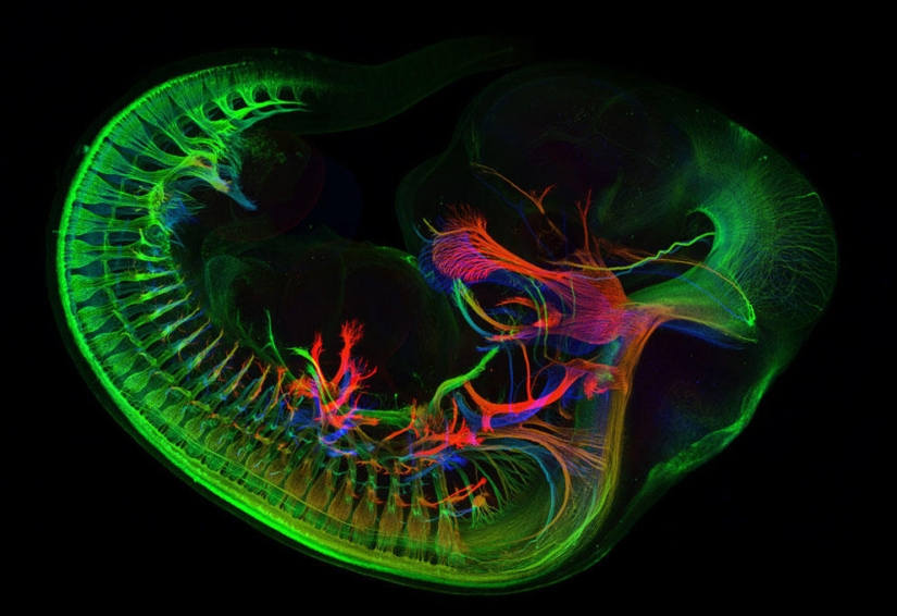 Concurso de fotomicrografía Nikon Small World 2013