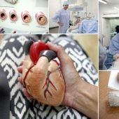 Cuestiones del Corazón, u Operación sin Cortes