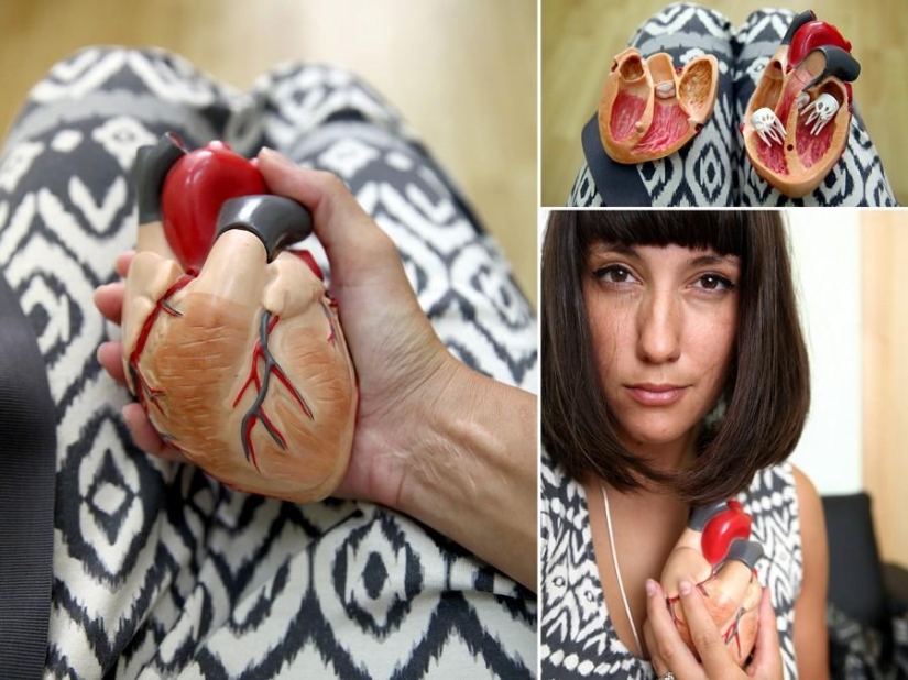 Cuestiones del Corazón, u Operación sin Cortes