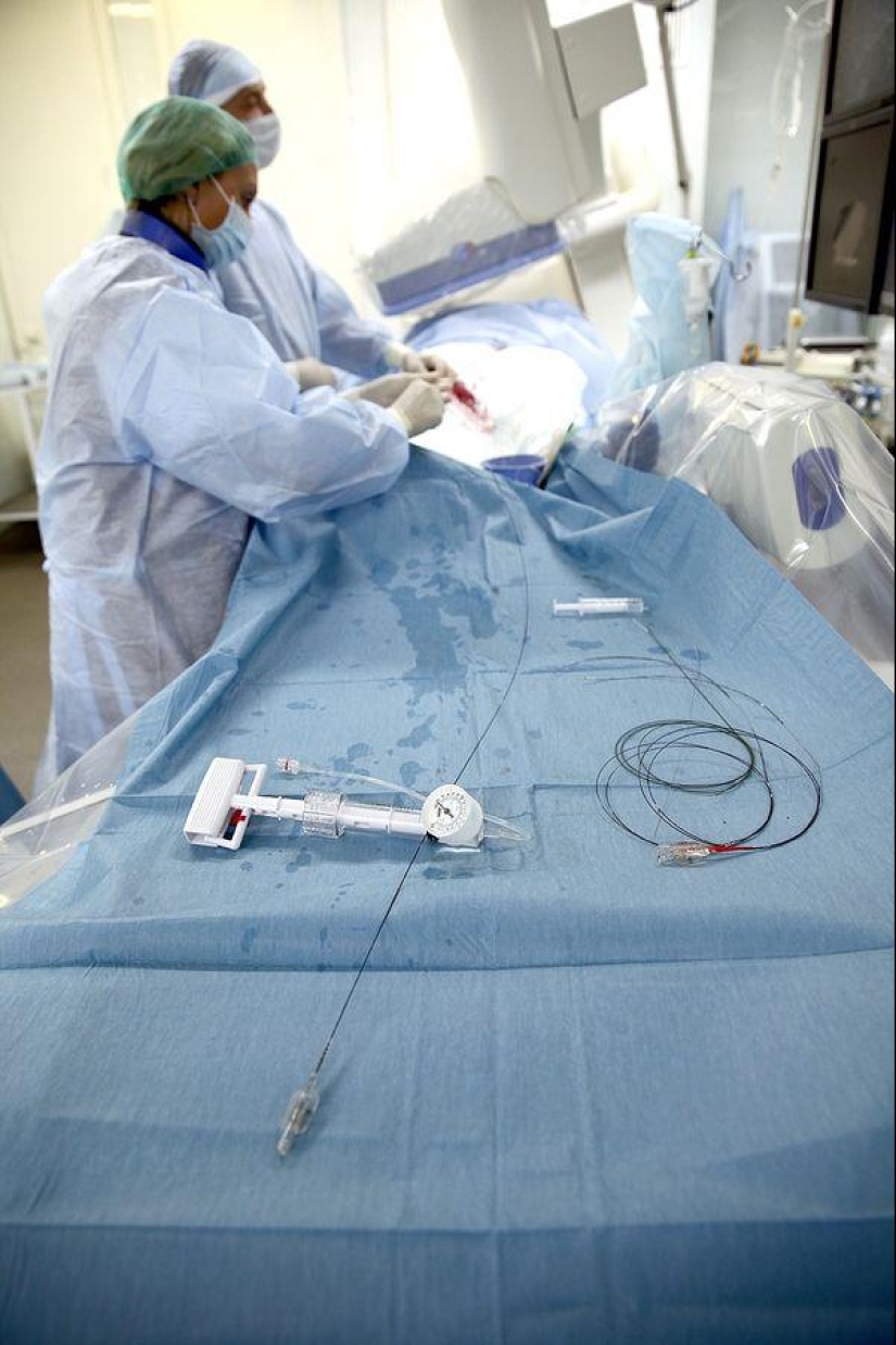 Cuestiones del Corazón, u Operación sin Cortes