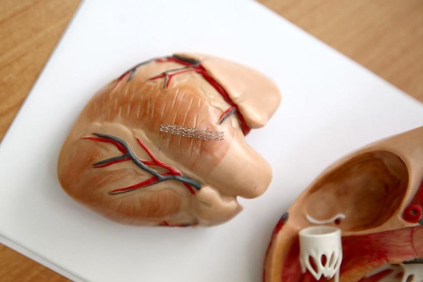 Cuestiones del Corazón, u Operación sin Cortes