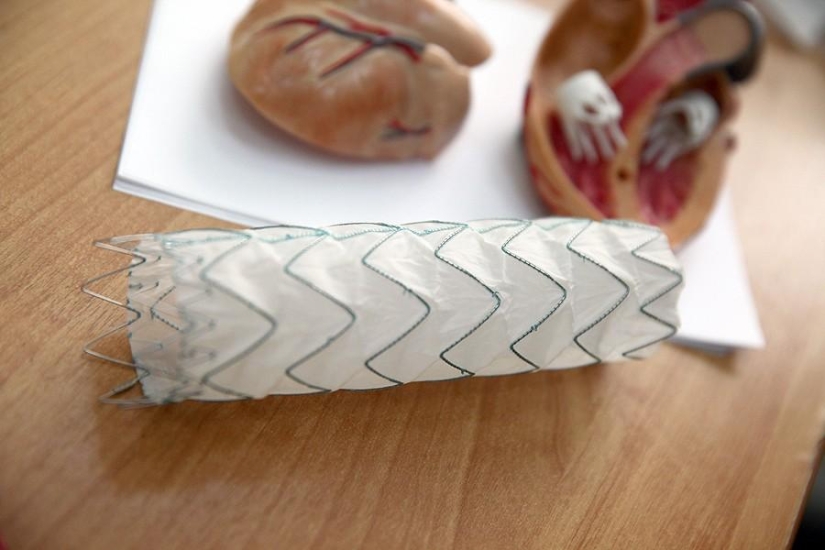 Cuestiones del Corazón, u Operación sin Cortes