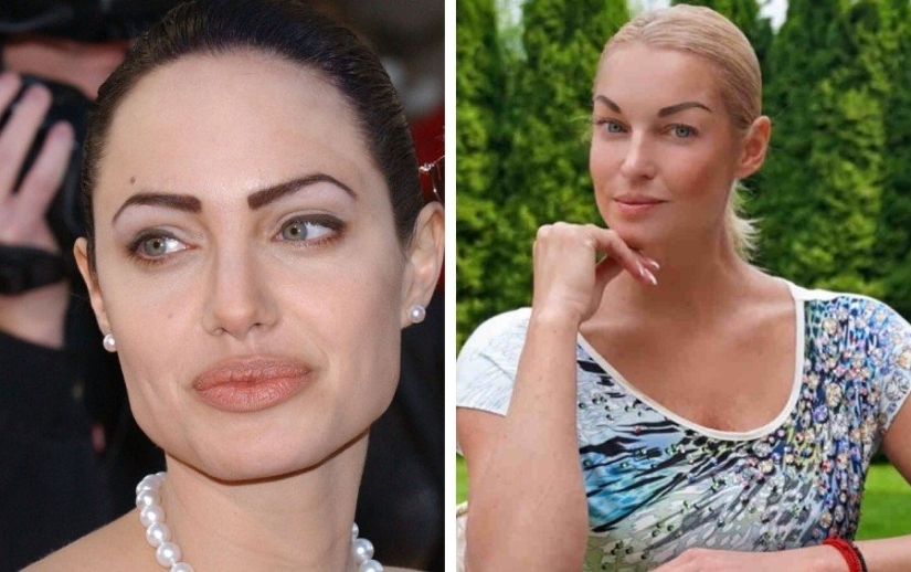 Don’t go to the beautician: 9 most dangerous and useless beauty procedures