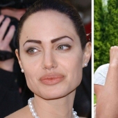 Don’t go to the beautician: 9 most dangerous and useless beauty procedures Don’t go to the beautician: 9 most dangerous and useless beauty procedures