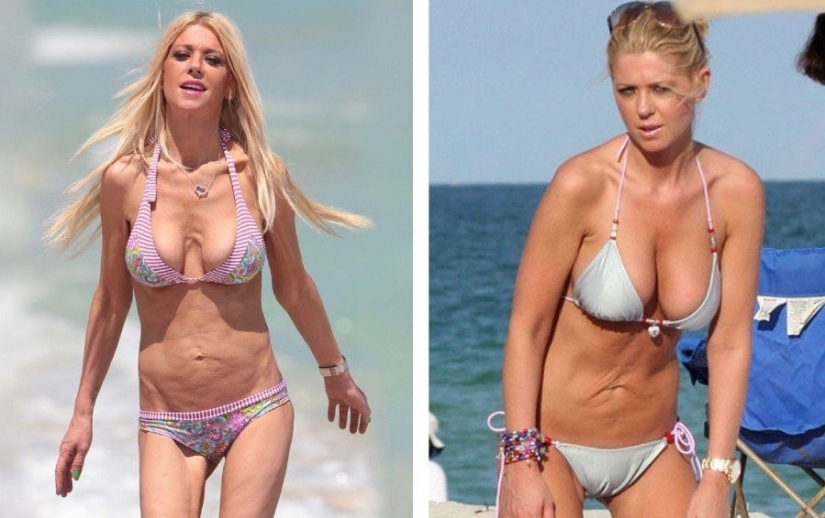 Don’t go to the beautician: 9 most dangerous and useless beauty procedures