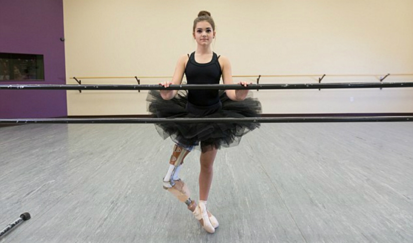 Ejemplo inspirador: una niña con una pierna protésica se convirtió en una bailarina maravillosa