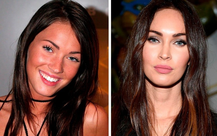 El cirujano hizo un gran trabajo: 10 estrellas con una cirugía plástica facial perfecta El cirujano hizo un gran trabajo: 10 estrellas con una cirugía plástica facial perfecta
