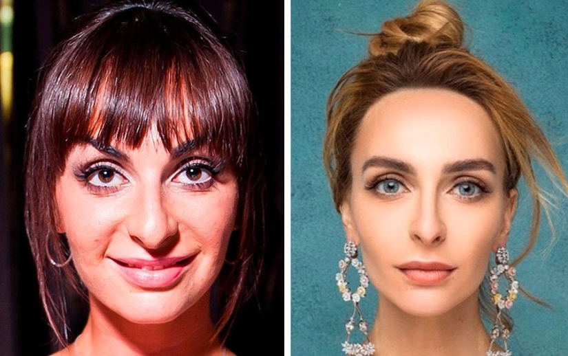 El cirujano hizo un gran trabajo: 10 estrellas con una cirugía plástica facial perfecta El cirujano hizo un gran trabajo: 10 estrellas con una cirugía plástica facial perfecta
