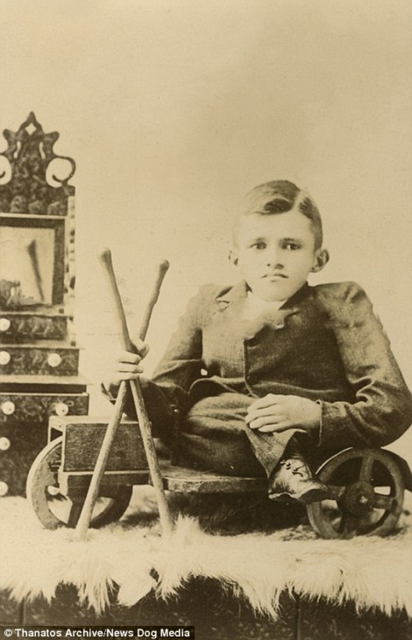 El duro siglo XIX: una colección de fotografías de archivo de personas con deformidades