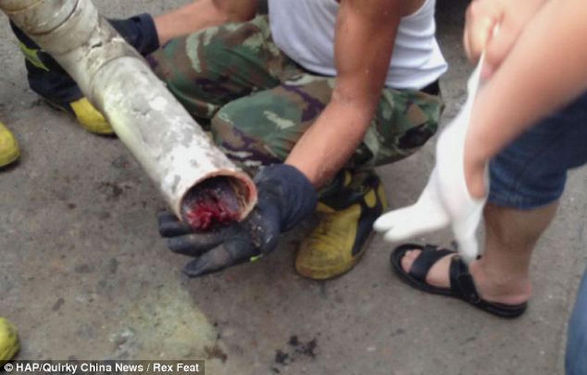 En China, un recién nacido fue rescatado después de ser tirado por el inodoro En China, un recién nacido fue rescatado después de ser tirado por el inodoro