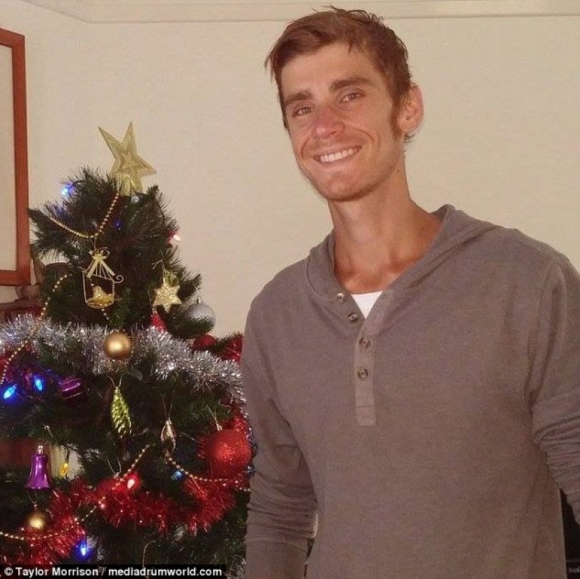 Everything is good in moderation: an obese man lost half his weight and became like Koshchei the Immortal