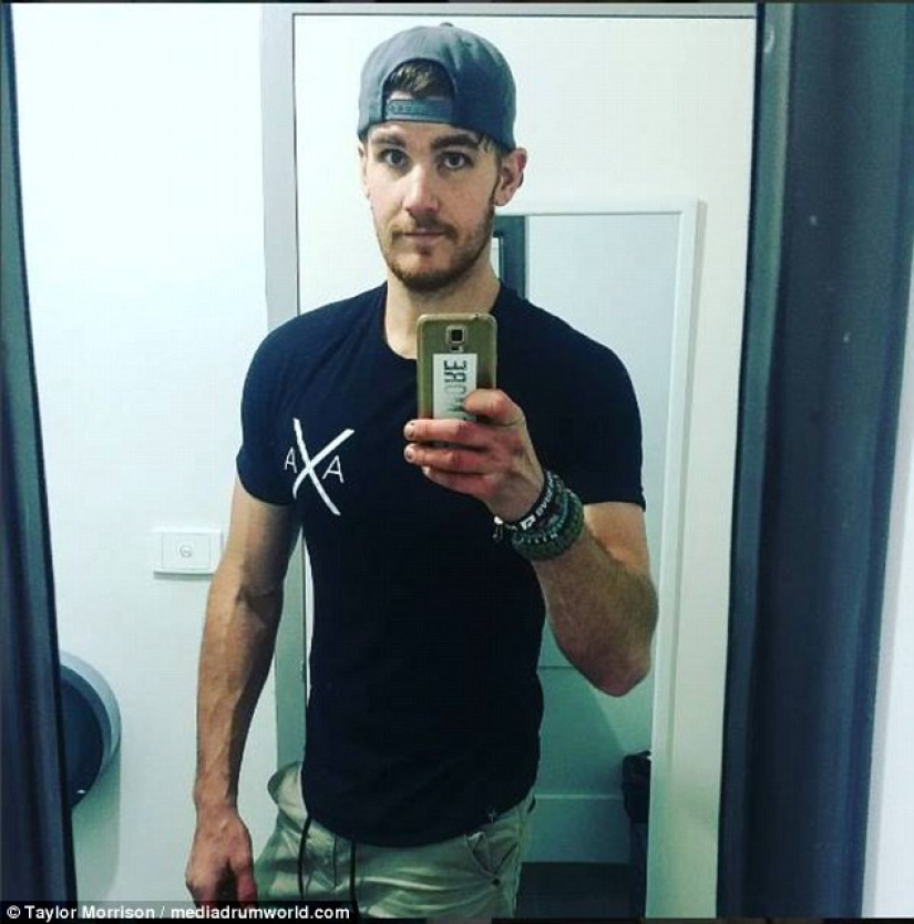 Everything is good in moderation: an obese man lost half his weight and became like Koshchei the Immortal