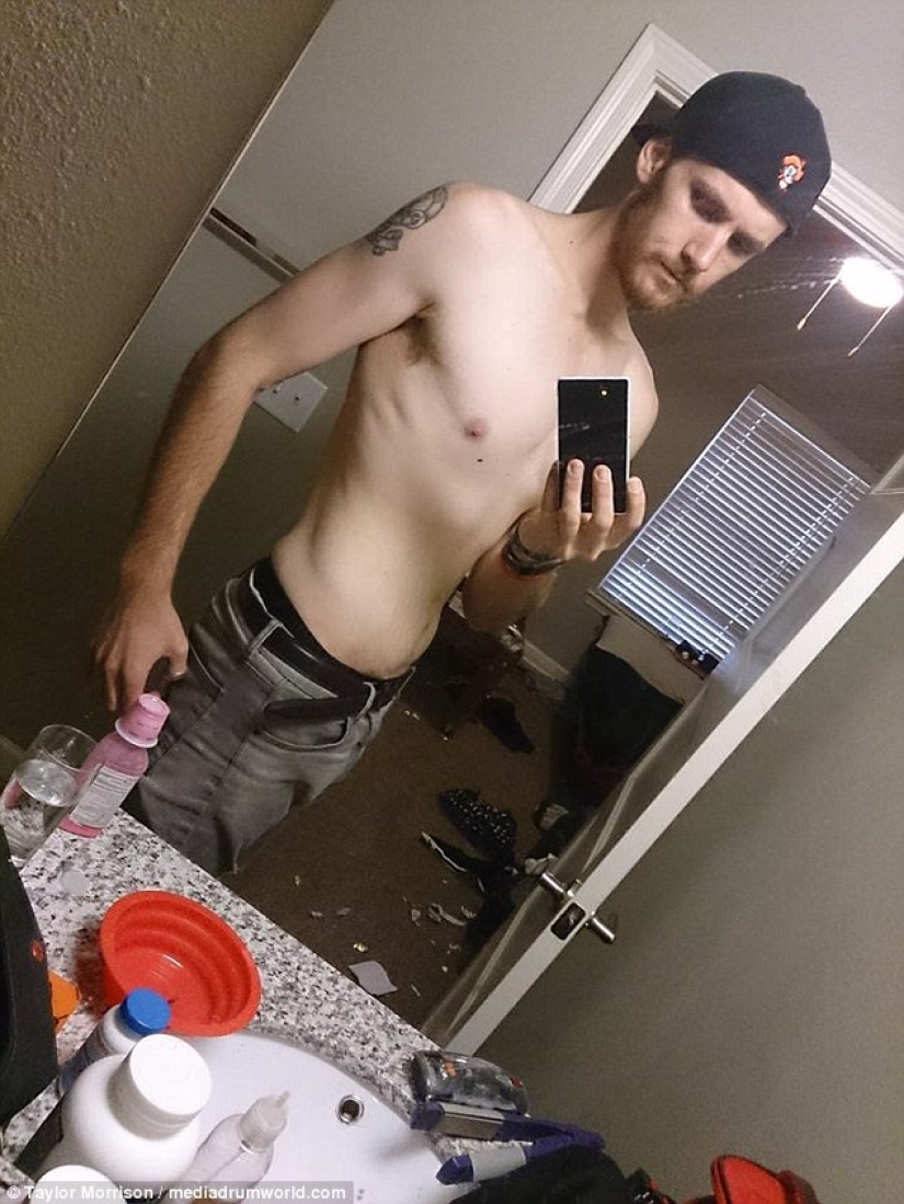 Everything is good in moderation: an obese man lost half his weight and became like Koshchei the Immortal