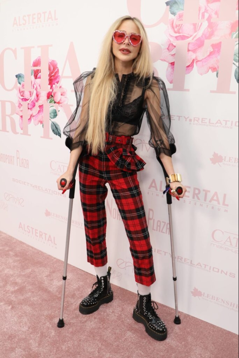 German model lengthened her legs by 14 cm and is not going to stop