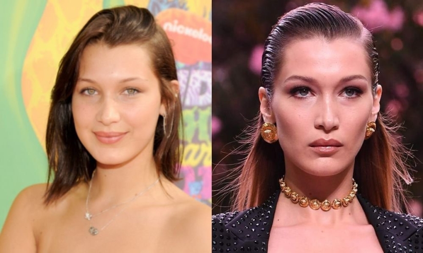 Getting plastic surgery was the best decision: 10 miraculous transformations of stars