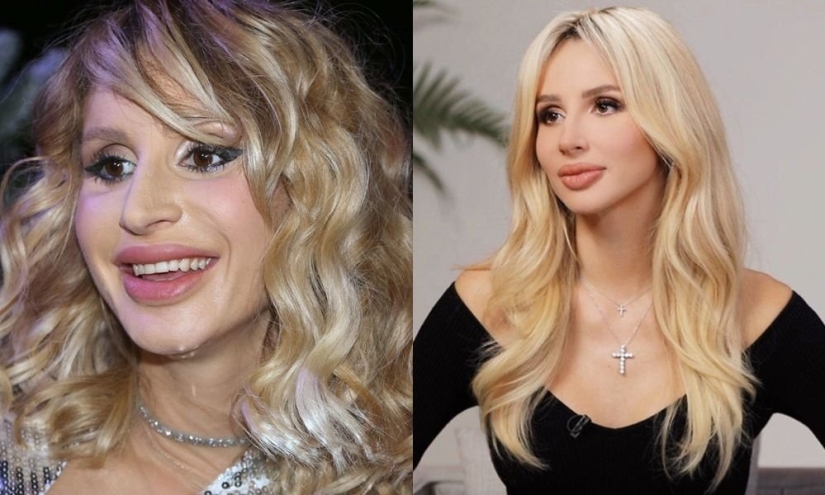 Getting plastic surgery was the best decision: 10 miraculous transformations of stars