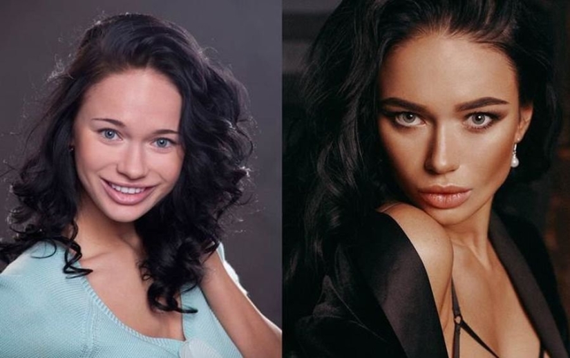 Getting plastic surgery was the best decision: 10 miraculous transformations of stars