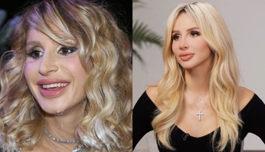 Getting plastic surgery was the best decision: 10 miraculous transformations of stars