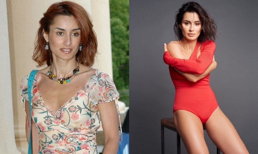 Getting plastic surgery was the best decision: 10 miraculous transformations of stars