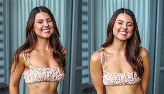 Girl challenges unrealistic fashion and beauty standards with her photos: 12 photos Girl challenges unrealistic fashion and beauty standards with her photos: 12 photos