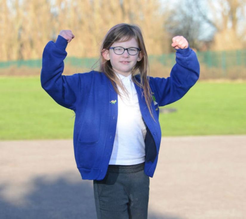 &quot;Girl of Steel&quot;: 7-year-old schoolgirl does not feel hunger, pain and fatigue