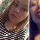 Girls try to make their lips plump like a TV star. It doesn&#39;t turn out very...