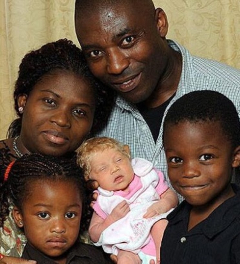 Hace 11 años, nació un "ángel blanco" de una pareja nigeriana. Que belleza se ha vuelto la chica con los años