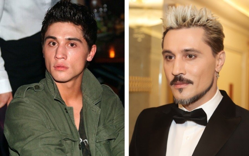 Hombres 9 estrellas que se han sometido a cirugía plástica: quiénes se pusieron más guapos y quiénes se arrepintieron Hombres 9 estrellas que se han sometido a cirugía plástica: quiénes se pusieron más guapos y quiénes se arrepintieron