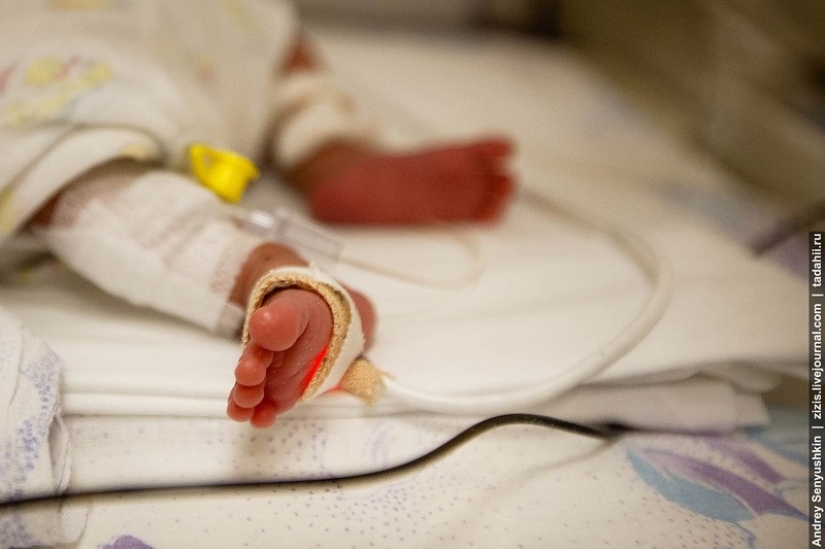 How are newborns saved? Report from pediatric intensive care How are newborns saved? Report from pediatric intensive care