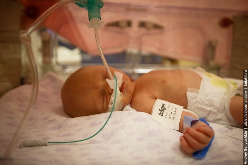 How are newborns saved? Report from pediatric intensive care How are newborns saved? Report from pediatric intensive care