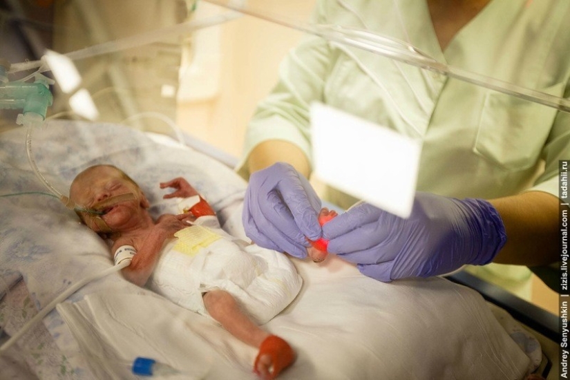 How are newborns saved? Report from pediatric intensive care How are newborns saved? Report from pediatric intensive care