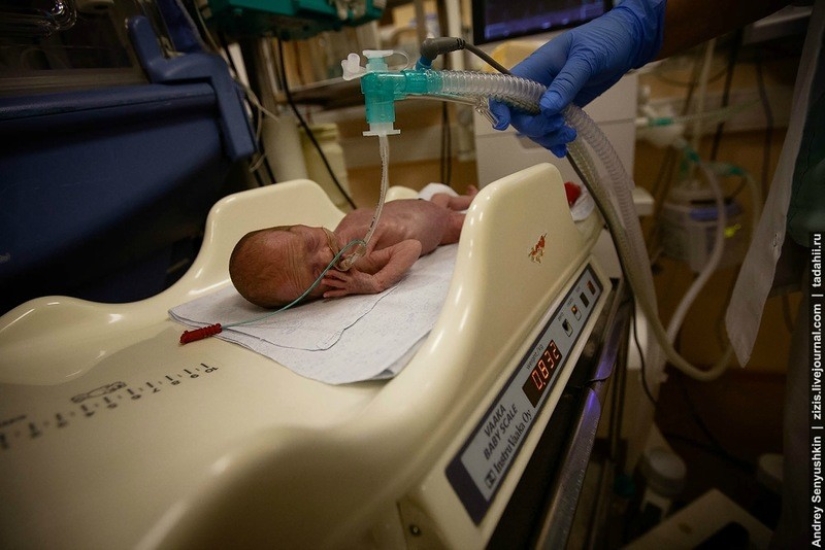 How are newborns saved? Report from pediatric intensive care How are newborns saved? Report from pediatric intensive care