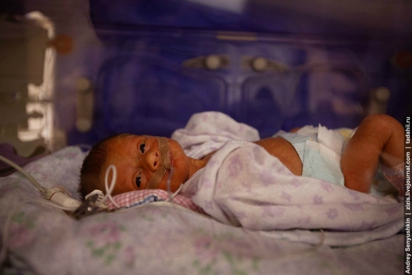 How are newborns saved? Report from pediatric intensive care How are newborns saved? Report from pediatric intensive care