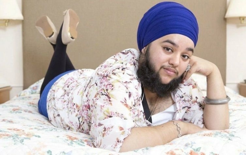 How to accept yourself: a girl with a beard in frames that she is not afraid to show to society