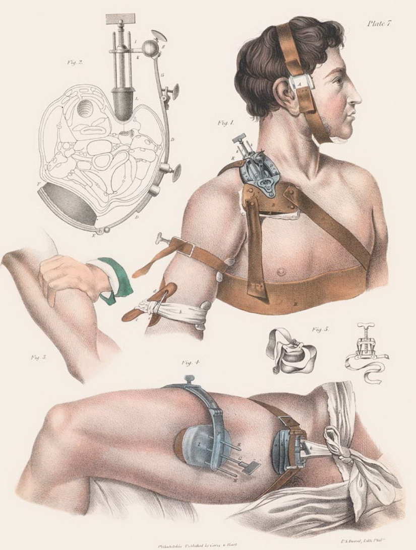 How were surgeries done at the beginning of the last century